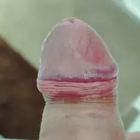 alemaosc
