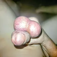 LuridFinial