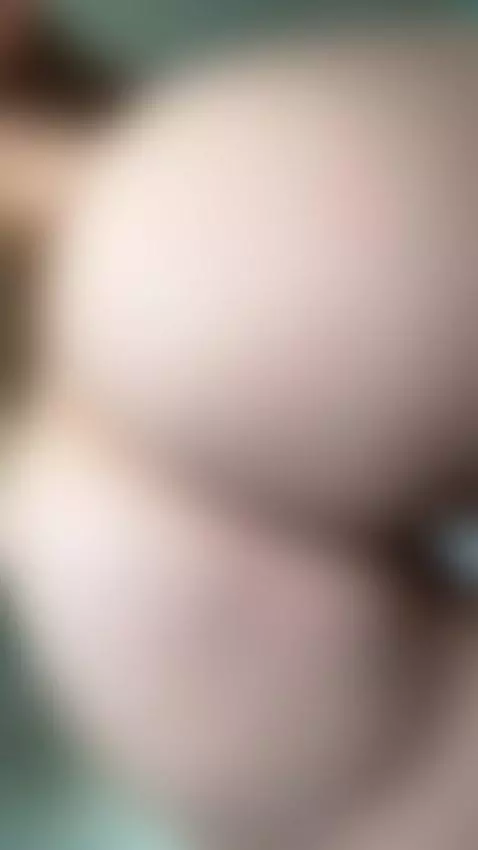 did you even notice my bruise? 😜 by danidaniels