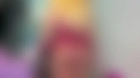 sunburnt body by jacksonchloex