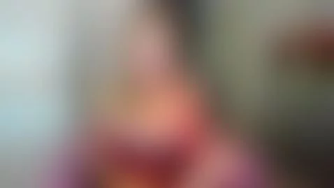 sunburnt body by jacksonchloex