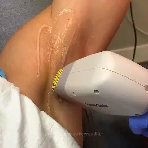 depilo mi by keyramiller