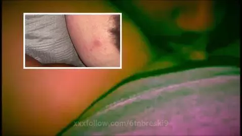 munchies by 6tnbreski9