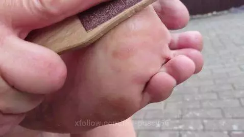 Outdoor foot care on the left foot by hot-pussy66