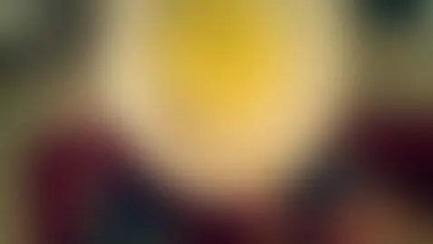 Pee after Contrast Medua injection! It glows! by theclubist111