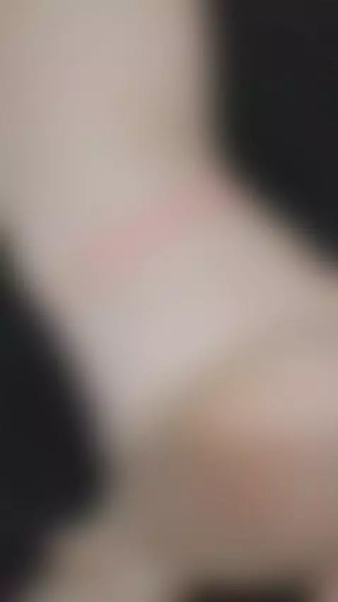 I wish you were my rash 🫠 by loidjanne