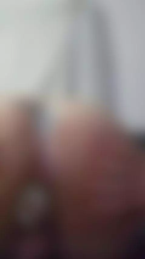 Electrode Asshole!
~It's Electrifying~ by astonishededema