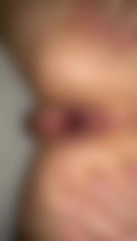 They fuck me doggy style in my ass, to fisting in my ass hol... by lucasbennett