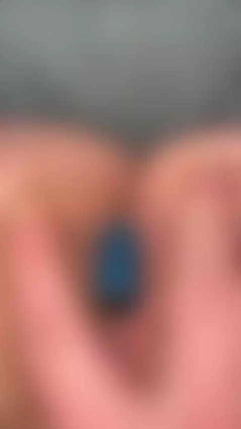 its massage my rosebutt too hard... i cum immediatly 💦🍆❤️📳💗🫨... by faze040