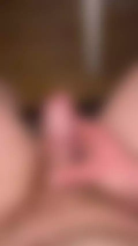 forehead is wired and locked, so my pee can't get out. its t... by faze040