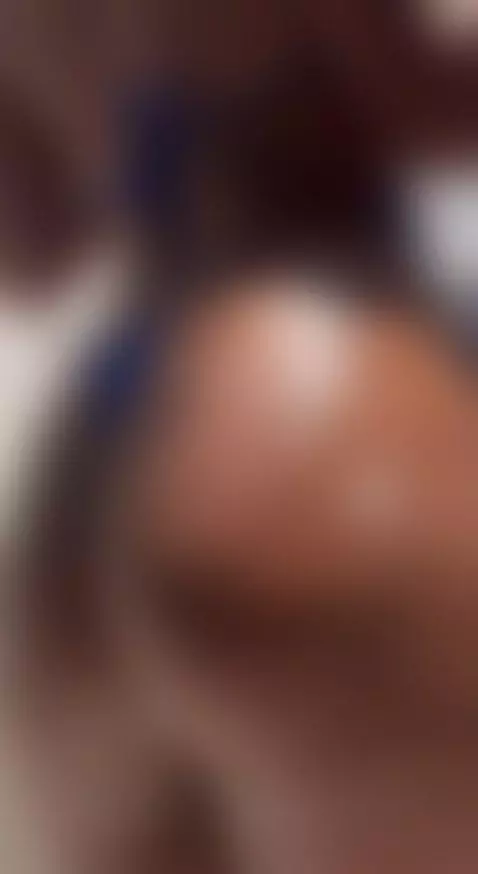 ☀️ turning myself into a sexy fried egg by lilacohen