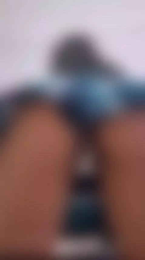 I feel that my skin burns ... and it is not because of the h... by nahomycarther