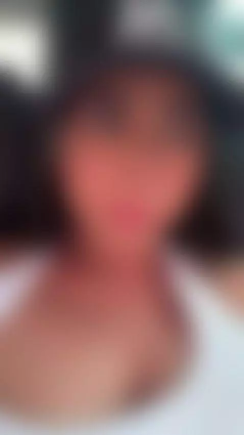 Every scar has a story… but tonight I want to write a new on... by adharataylor