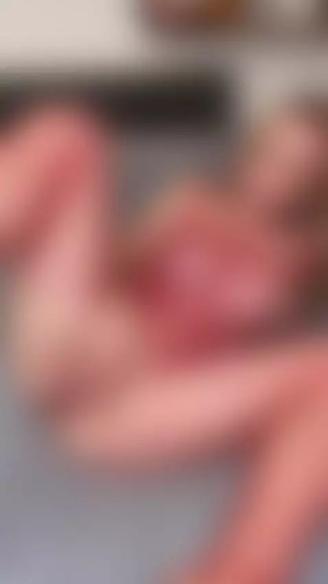 You won't look away, you won't take your eyes off my wet pus... by marimoore-of