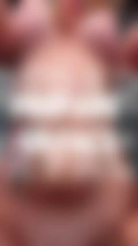 My tits raised and my chest fooly nude 🔥 Fansly by shinylily